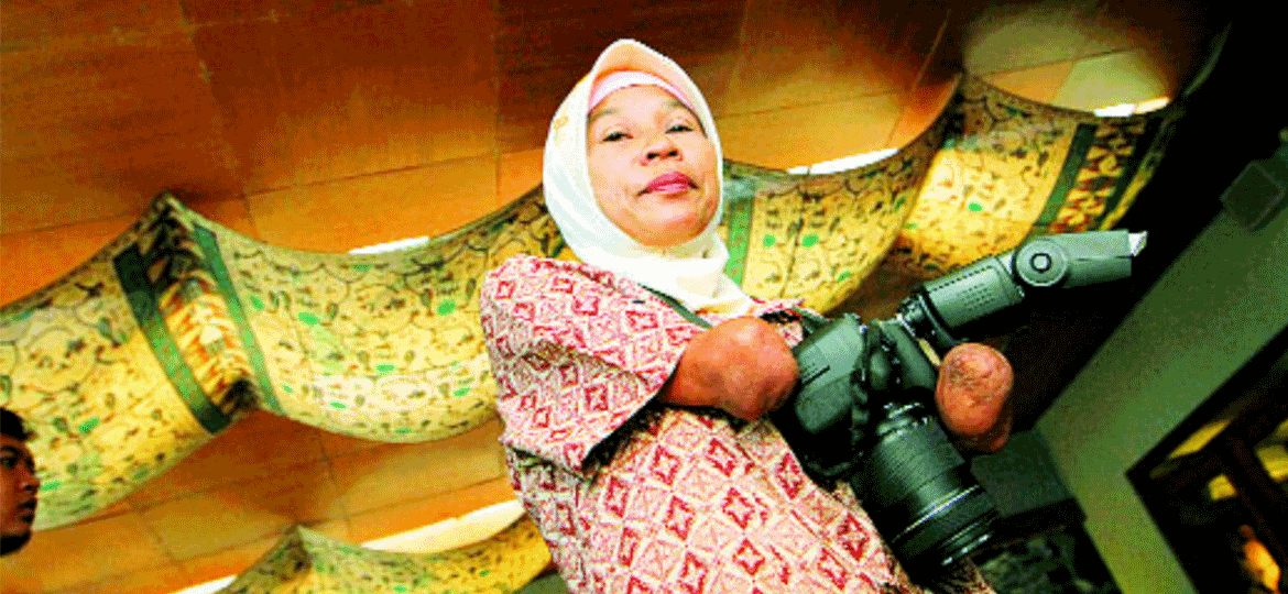 Rusidah Badawi woman without forearms